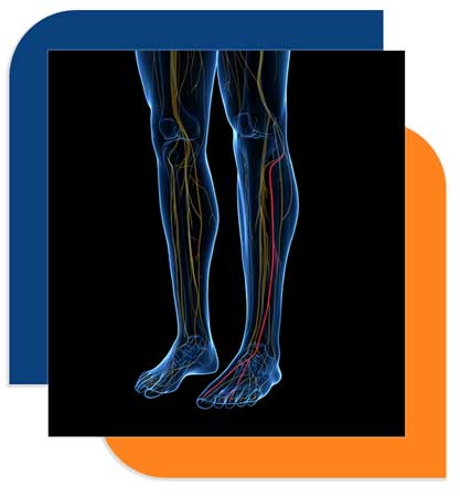nerve damage in legs causing peripheral neuropathy