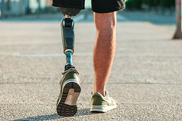 Patient needing phantom limb pain relief in Orange